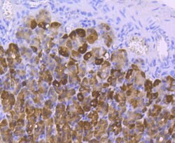 Invitrogen Carbonic anhydrase II Recombinant Rabbit Monoclonal Antibody