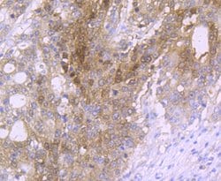 Invitrogen Carbonic anhydrase II Recombinant Rabbit Monoclonal Antibody