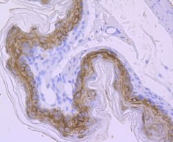 Invitrogen Carbonic anhydrase II Recombinant Rabbit Monoclonal Antibody
