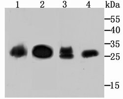 Invitrogen Carbonic anhydrase II Recombinant Rabbit Monoclonal Antibody