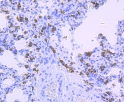 Invitrogen HLA-DQA1 Recombinant Rabbit Monoclonal Antibody (JU17-34) 100