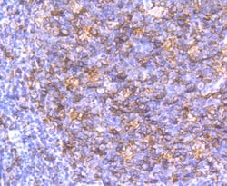 Invitrogen HLA-DQA1 Recombinant Rabbit Monoclonal Antibody (JU17-34) 100