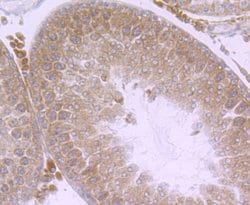 Invitrogen Nuclear Matrix Protein p84 Recombinant Rabbit Monoclonal Antibody