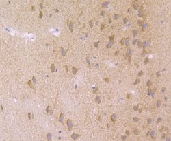 Invitrogen Nuclear Matrix Protein p84 Recombinant Rabbit Monoclonal Antibody