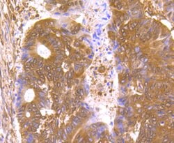 Invitrogen Nuclear Matrix Protein p84 Recombinant Rabbit Monoclonal Antibody