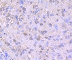 Invitrogen Nuclear Matrix Protein p84 Recombinant Rabbit Monoclonal Antibody