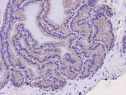 Invitrogen SQSTM1 Monoclonal Antibody (10-E10) 100 μL; Unconjugated:Antibodies,