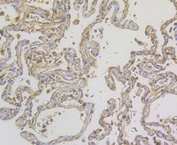 Invitrogen ORM1 Monoclonal Antibody (A4-G2-A3) 100 &mu;L; Unconjugated:Antibodies,