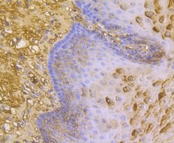 Invitrogen ORM1 Monoclonal Antibody (A4-G2-A3) 100 &mu;L; Unconjugated:Antibodies,