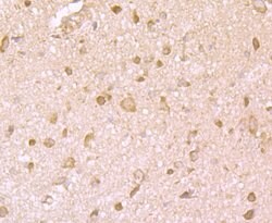 Invitrogen IGF2BP3 Monoclonal Antibody (C2-E4) 100 &mu;L; Unconjugated:Antibodies,