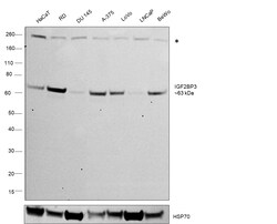 Invitrogen IGF2BP3 Monoclonal Antibody (C2-E4) 100 &mu;L; Unconjugated:Antibodies,