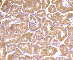 Invitrogen AKR1C1 Monoclonal Antibody (5-F10) 100 &mu;L | Buy Online | Invitrogen&trade; | Fisher Scientific