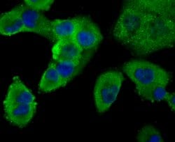 Invitrogen PCSK9 Monoclonal Antibody (2F1) 100 &mu;L; Unconjugated:Antibodies,