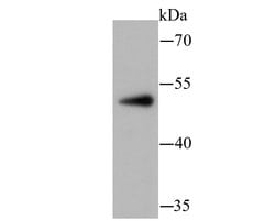 Invitrogen PCSK9 Monoclonal Antibody (2F1) 100 &mu;L; Unconjugated:Antibodies,