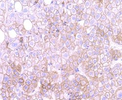 Invitrogen MTERFD1 Monoclonal Antibody (A8-A10) 100 &mu;L; Unconjugated:Antibodies,