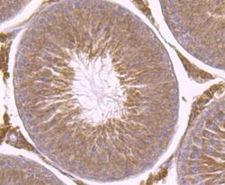 Invitrogen B-Raf Monoclonal Antibody (F1-F4-E10) 100 &mu;L; Unconjugated:Antibodies,
