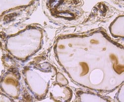 Invitrogen B-Raf Monoclonal Antibody (F1-F4-E10) 100 &mu;L; Unconjugated:Antibodies,