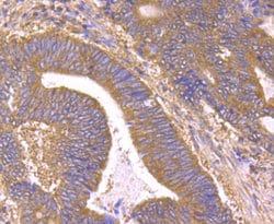 Invitrogen B-Raf Monoclonal Antibody (F1-F4-E10) 100 &mu;L; Unconjugated:Antibodies,