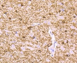 Invitrogen B-Raf Monoclonal Antibody (F1-F4-E10) 100 &mu;L; Unconjugated:Antibodies,