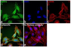 Invitrogen PRMT5 Monoclonal Antibody (7-C2) 100 &mu;L; Unconjugated:Antibodies,