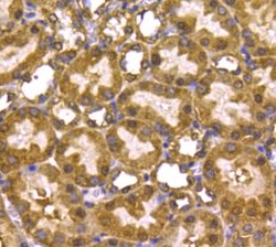 Invitrogen PRMT5 Monoclonal Antibody (7-C2) 100 &mu;L; Unconjugated:Antibodies,