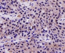 Invitrogen PRMT5 Monoclonal Antibody (7-C2) 100 &mu;L; Unconjugated:Antibodies,