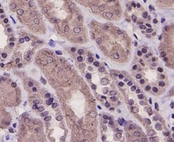 Invitrogen PRMT5 Monoclonal Antibody (7-C2) 100 &mu;L; Unconjugated:Antibodies,