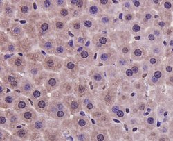 Invitrogen PRMT5 Monoclonal Antibody (7-C2) 100 &mu;L; Unconjugated:Antibodies,