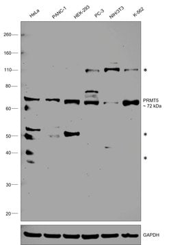 Invitrogen PRMT5 Monoclonal Antibody (7-C2) 100 &mu;L; Unconjugated:Antibodies,