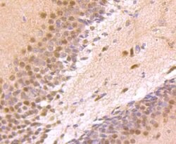Invitrogen ZIC1 Recombinant Rabbit Monoclonal Antibody (JA31-60) 100 &mu;L;