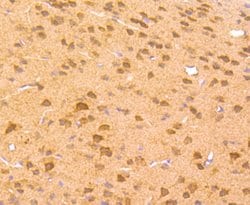 Invitrogen ZIC1 Recombinant Rabbit Monoclonal Antibody (JA31-60) 100 &mu;L;