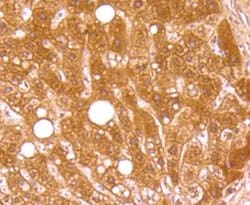 Invitrogen Complement C4 Recombinant Rabbit Monoclonal Antibody (JM88-13)