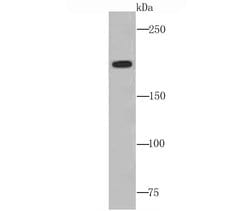 Invitrogen Complement C4 Recombinant Rabbit Monoclonal Antibody (JM88-13)
