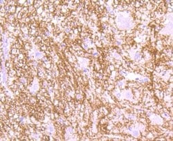 Invitrogen MOG Recombinant Rabbit Monoclonal Antibody (JM23-06) 100 &mu;L | Buy Online | Invitrogen&trade; | Fisher Scientific