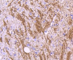 Invitrogen MOG Recombinant Rabbit Monoclonal Antibody (JM23-06) 100 &mu;L | Buy Online | Invitrogen&trade; | Fisher Scientific