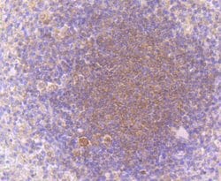 Invitrogen PKC beta-1 Recombinant Rabbit Monoclonal Antibody (JM43-26) 100 &mu;L | Buy Online | Invitrogen&trade; | Fisher Scientific