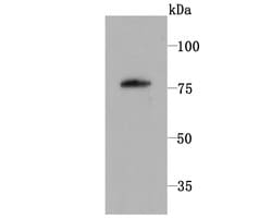 Invitrogen PKC beta-1 Recombinant Rabbit Monoclonal Antibody (JM43-26) 100 &mu;L | Buy Online | Invitrogen&trade; | Fisher Scientific