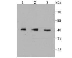 Invitrogen IkB epsilon Recombinant Rabbit Monoclonal Antibody (JM62-63)