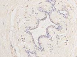 Invitrogen Cyclin E2 Monoclonal Antibody (40-89) 100 &mu;L; Unconjugated:Antibodies,