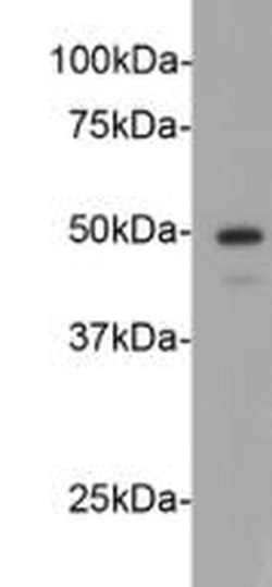Invitrogen Cyclin E2 Monoclonal Antibody (40-89) 100 &mu;L; Unconjugated:Antibodies,