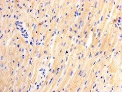 Invitrogen JPH2 Monoclonal Antibody (3-2) 100 &mu;L; Unconjugated:Antibodies,