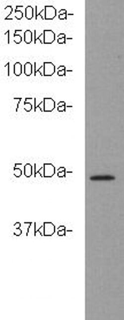 Invitrogen KIDINS220 Monoclonal Antibody (3-B6) 100 &mu;L; Unconjugated:Antibodies,