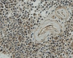 Invitrogen CCDC51 Monoclonal Antibody (A8-F4-D1) 100 &mu;L; Unconjugated:Antibodies,