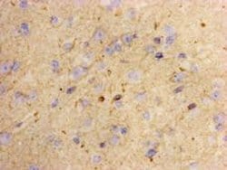 Invitrogen Lass2 Monoclonal Antibody (B3-2) 100 &mu;L; Unconjugated:Antibodies,
