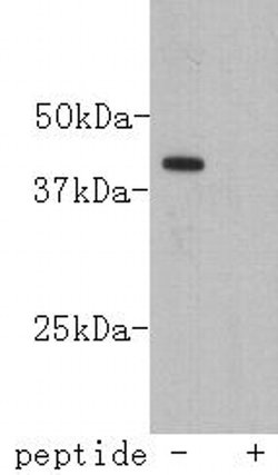 Invitrogen Lass2 Monoclonal Antibody (B3-2) 100 &mu;L; Unconjugated:Antibodies,