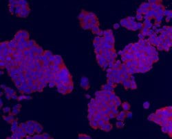 Invitrogen TMEM200A Monoclonal Antibody (4-B3) 100 &mu;L; Unconjugated:Antibodies,