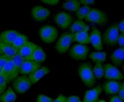 Invitrogen TMEM200A Monoclonal Antibody (4-B3) 100 &mu;L; Unconjugated:Antibodies,