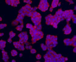 Invitrogen TMEM200A Monoclonal Antibody (4-B3) 100 &mu;L; Unconjugated:Antibodies,