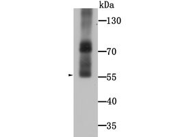 Invitrogen WSCD2 Monoclonal Antibody (9-F3) 100 &mu;L; Unconjugated:Antibodies,