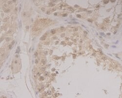 Invitrogen GRAMD1A Monoclonal Antibody (1-E4) 100 &mu;L | Buy Online | Invitrogen&trade; | Fisher Scientific